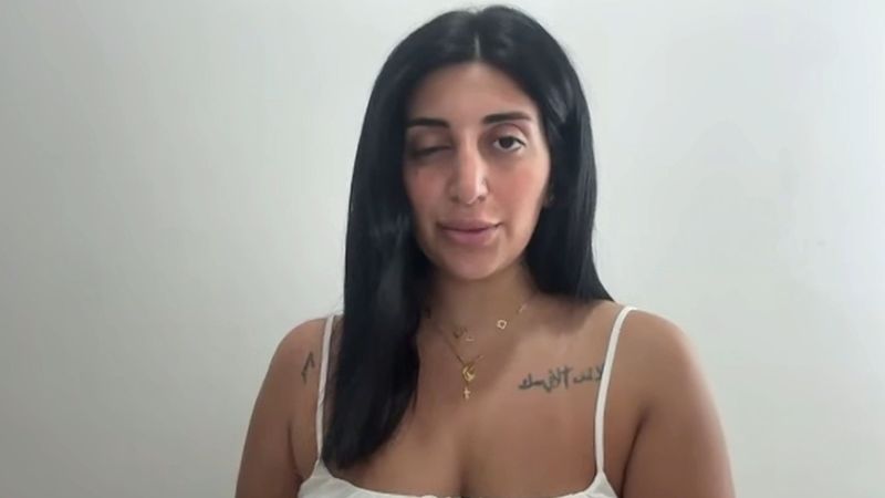 بعد غلطة "دكاكين التجميل"... تيا تستعيد بصرها!